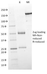 Data from SDS-PAGE analysis of Anti-GAD1 antibody (Clone GAD1/2563). Reducing lane (R) shows heavy and light chain fragments. NR lane shows intact antibody with expected MW of approximately 150 kDa. The data are consistent with a high purity, intact mAb.